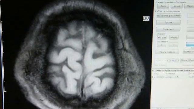 Смотреть слево в лоб-там пробой головного черепа смотреть онлайн