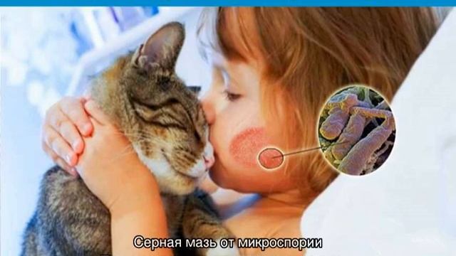 Микроспория гладкой кожи смотреть онлайн
