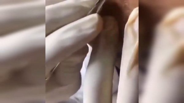 подборка выдавливания прыщей 25 II выдавливание прыщей