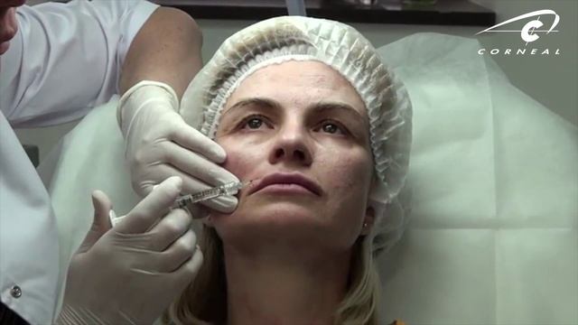 Поверхностная коррекция Princess Filler смотреть онлайн