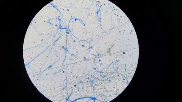 Mucor Structures under the Microscope at various magnifications