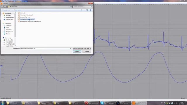 Обучающий видеоролик #6. ПО ECG Control. Импорт электрокардиограмм в формате EDF/EDF+