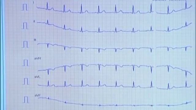 "Подари себе жизнь". Виктор Рыбин. Часть 3. смотреть онлайн