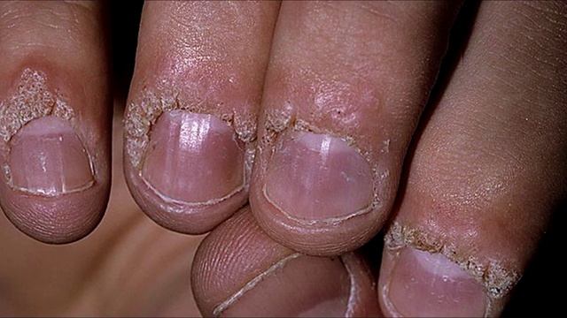 ПОЧЕМУ НЕЛЬЗЯ ГРЫЗТЬ НОГТИ?