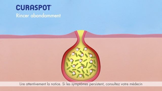 Curaspot - Pub 15s 2019 смотреть онлайн