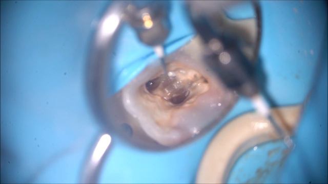 Извлечение сепарированного файла. смотреть онлайн