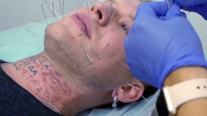 Жесткий эксперимент! 120 игл в лицо! Что будет? Метровая игла челлендж!