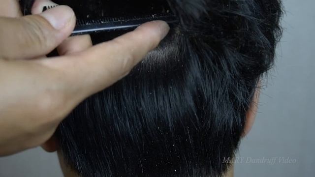 Dandruff #1262