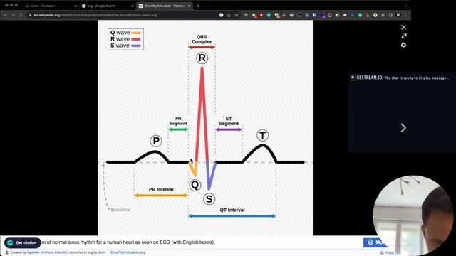 DIY WIFI enabled ECG device for $10 смотреть онлайн
