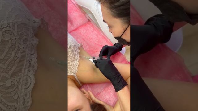 Лечение потливости тела#гипергидроз#повешенная потливость тела# смотреть онлайн