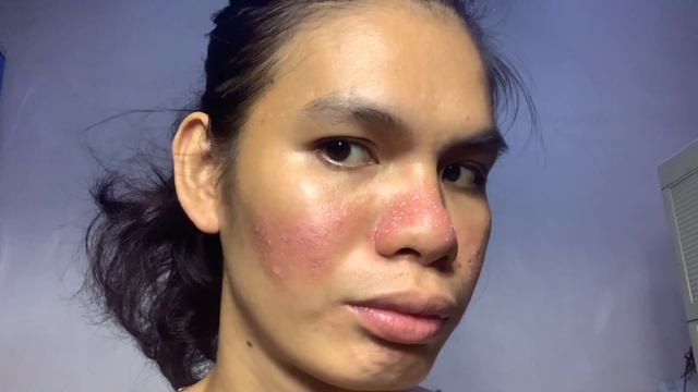 DIY TCA CROSS - 1st Session Using 100% Solution