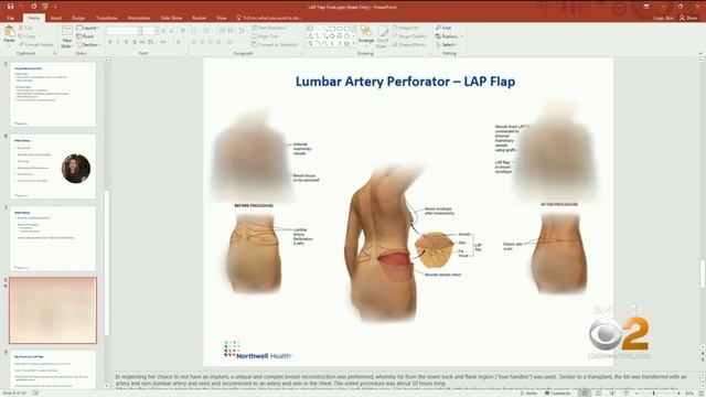 Doctors Make Progress With Rare Breast Reconstruction Technique смотреть онлайн