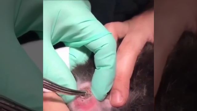 Larva removal-Удаление личинки смотреть онлайн