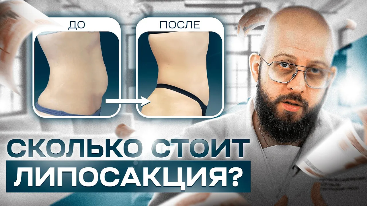 Как считается СТОИМОСТЬ ЛИПОСАКЦИИ? смотреть онлайн