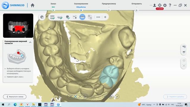 EXOCAD: БЕСПЛАТНЫЙ КУРС | УРОК 3: СКАНИРОВАНИЕ. ПЕРВЫЙ ВЗГЛЯД НА CAD смотреть онлайн