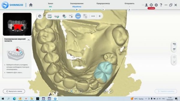 EXOCAD: БЕСПЛАТНЫЙ КУРС | УРОК 3: СКАНИРОВАНИЕ. ПЕРВЫЙ ВЗГЛЯД НА CAD