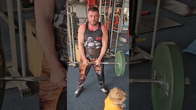 Передняя дельтавидная