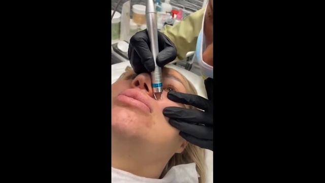 ОТЗЫВЫ LINE_COSMO |ОБУЧЕНИЕ |ЛАЗЕР УДАЛЕНИЕ СОСУДОВ 980nm смотреть онлайн