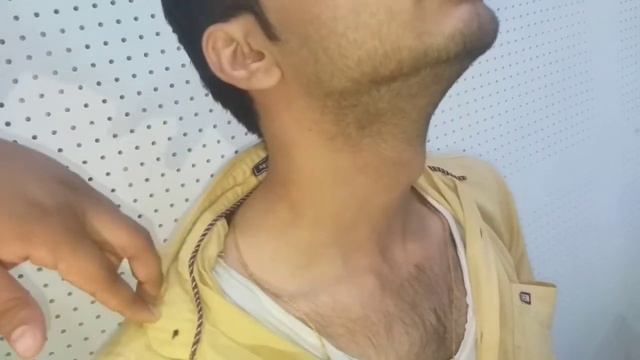 Neck Examination - Dr Mohan Bansal - Neck Triangles Lymph Nodes Inspection Palpation & Auscultation смотреть онлайн