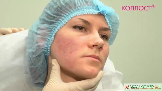 Коллост смотреть онлайн
