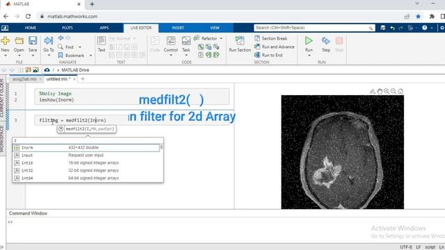 Median Filter || MATLAB Code Implementation || Medical Image Processing смотреть онлайн