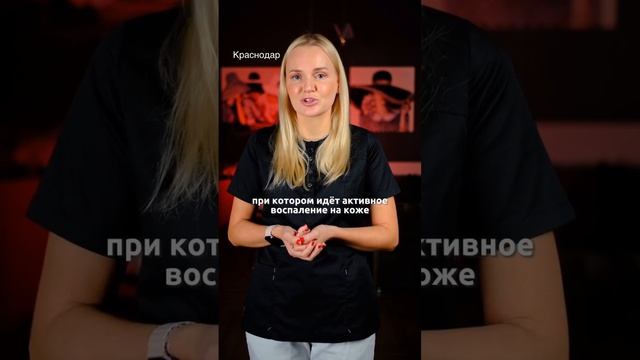 ДЕГТЯРНОЕ МЫЛО ПРИ АКНЕ смотреть онлайн