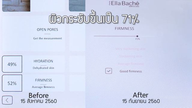 Review Ella bache tissulex смотреть онлайн