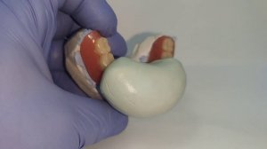 Приварка четырёх зубов на акриловый зубной протез!