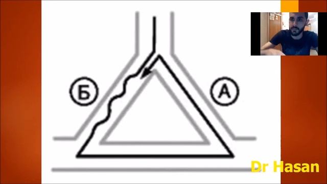 аритмия - нарушений ритма сердца ( Электрофизиологические механизмы ) смотреть онлайн