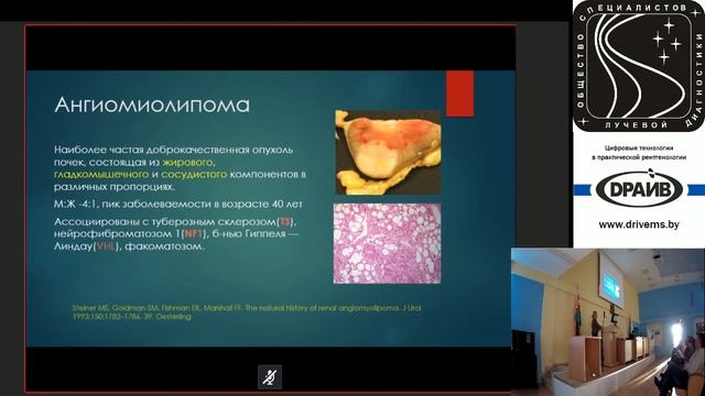 Современные аспекты дифференциальной диагностики образований почек методами рентгеновской КТ и МРТ смотреть онлайн