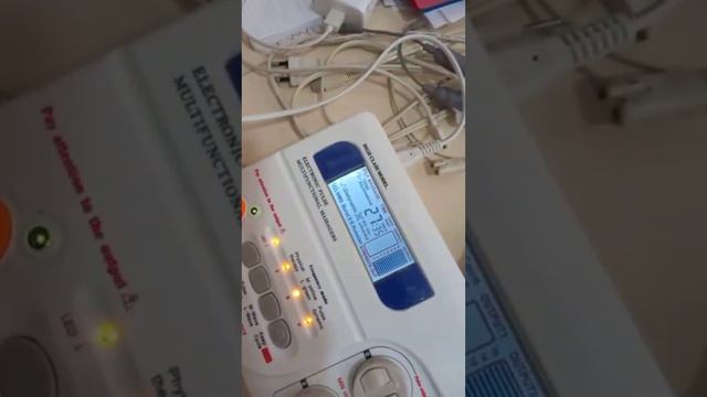 ZINDA 18 APPARATINING QALBAKI NUSXASIGA ALDANIB QOLMANG смотреть онлайн