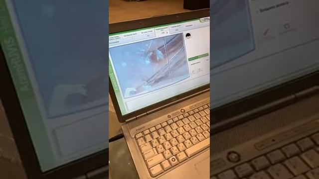 Прямой эфир 9.10.2019, часть 1: диагностика волос с помощью трихоскопа в салоне Амариллис смотреть онлайн