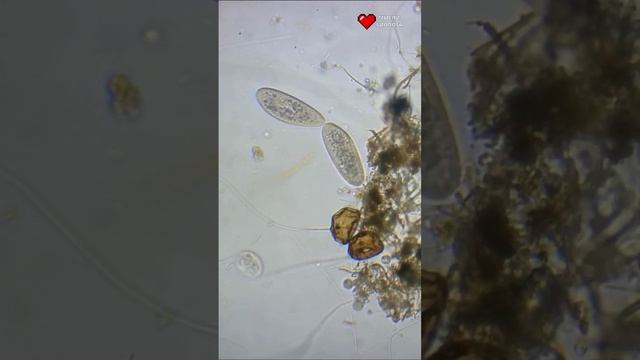 Размножение инфузорий смотреть онлайн