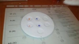 Как определить группу крови