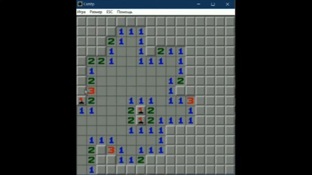 Сапер неправильно обезвредил мину и вот, что произошло... Слабонервным НЕ СМТОРЕТЬ! смотреть онлайн