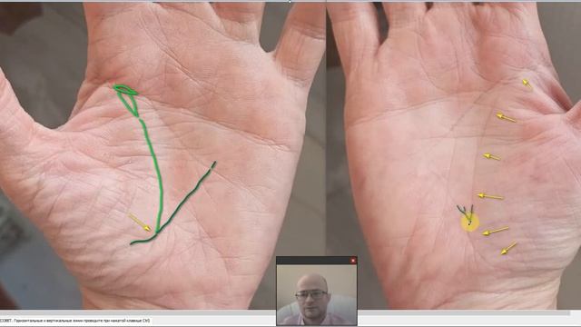 СОСТОЯНИЕ ЗДОРОВЬЯ ПО ЛИНИИ ЖИЗНИ. смотреть онлайн