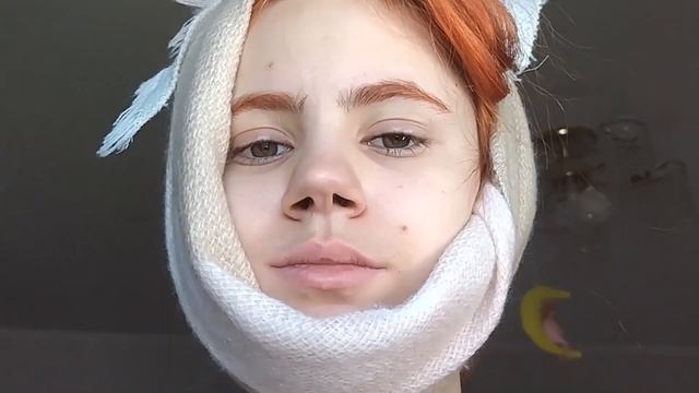 ЛЕЧУ ЗУБЫ?|| удалила 2 зуба мудрости смотреть онлайн