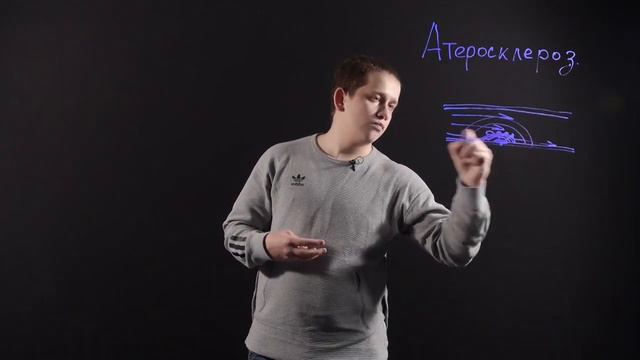 Атеросклероз к 29.09.22 смотреть онлайн