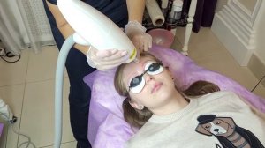 Удаление татуажа бровей лазером. Подробные этапы удаления татуажа бровей от Чемпиона России.