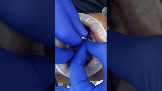 Делаем красивую улыбку)продолжение на канале… смотреть онлайн