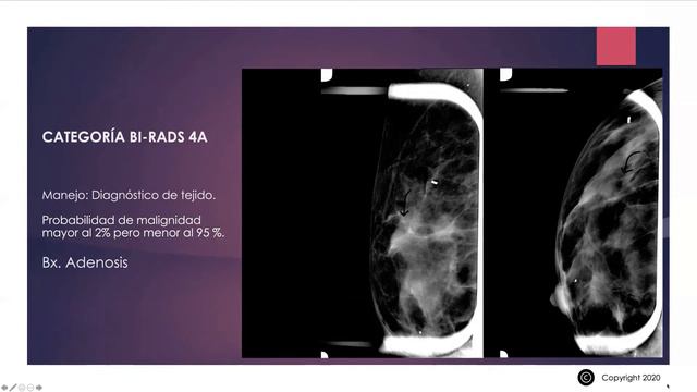 BI RADS mamográfico 2013 Viaje a la profundo смотреть онлайн