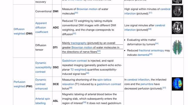 Magnetic resonance imaging (MRI) - Wikipedia смотреть онлайн