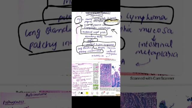 Git pathology 10 | chronic gestritis ( h pylori and antoimmune) | special pathology | Dr Zubia смотреть онлайн