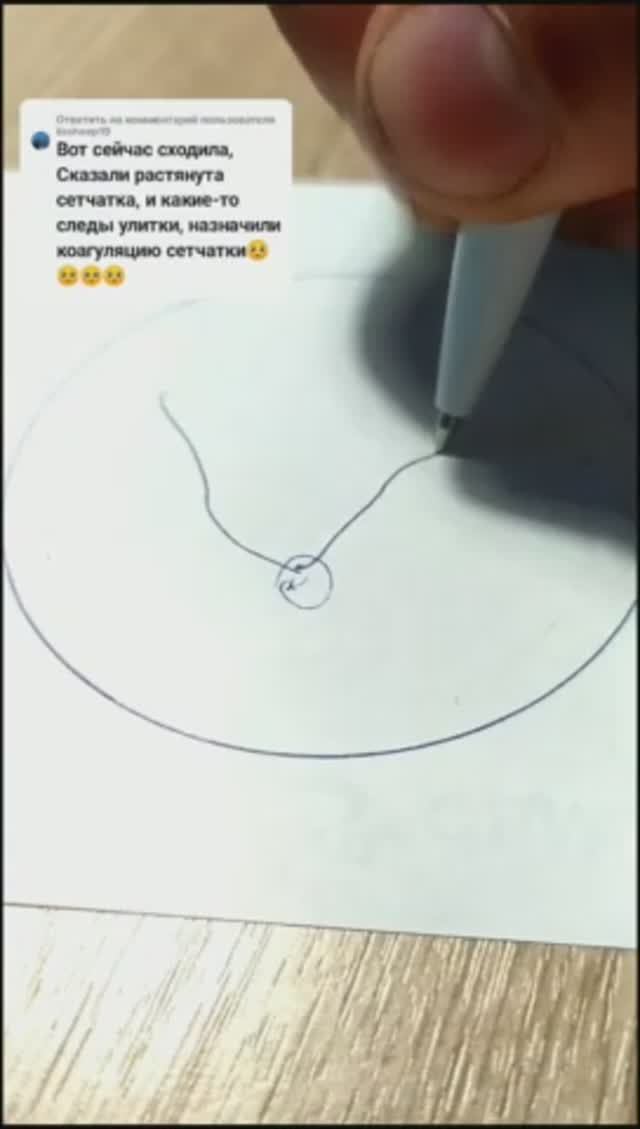 Улитка в глазу - это что?