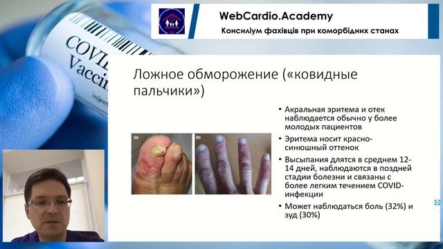 Ураження шкіри при COVID–19. Литвиненко Б.В. смотреть онлайн