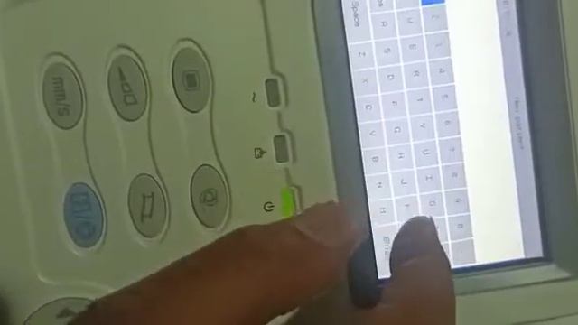 Biolight E30 Ecg how to start and add patient data смотреть онлайн