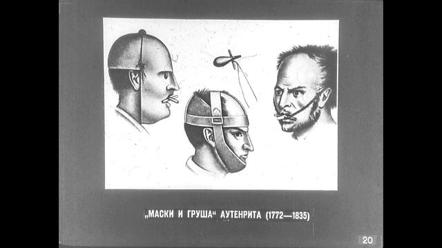 Диафильм Психиатрия 1 История зарубежной психиатрии смотреть онлайн