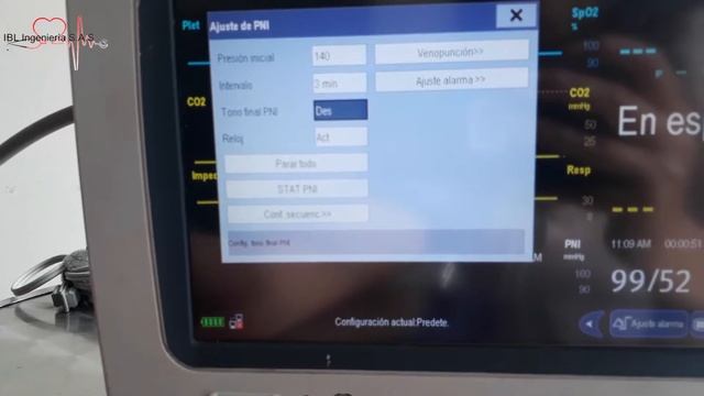 MONITOR IMEC8 NIBP смотреть онлайн