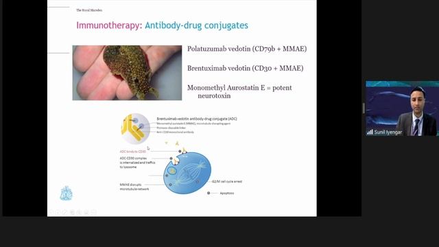 Advances in lymphoma therapy by Dr Sunil Iyengar смотреть онлайн