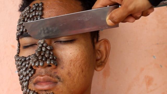 We Help Cleaning Million Big Ticks on Face Man With Knife That Work 100% #829 смотреть онлайн